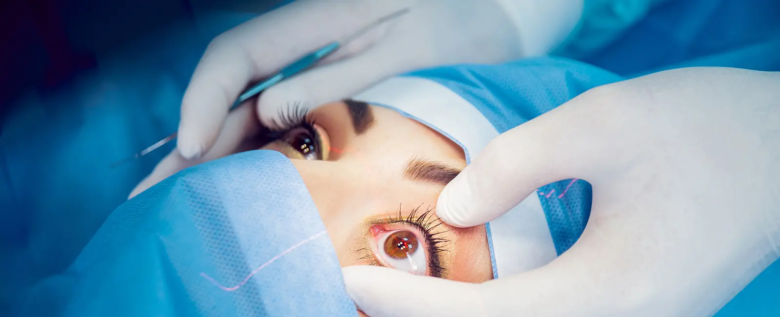 Determining Which Corrective Eye Surgery is Right for You