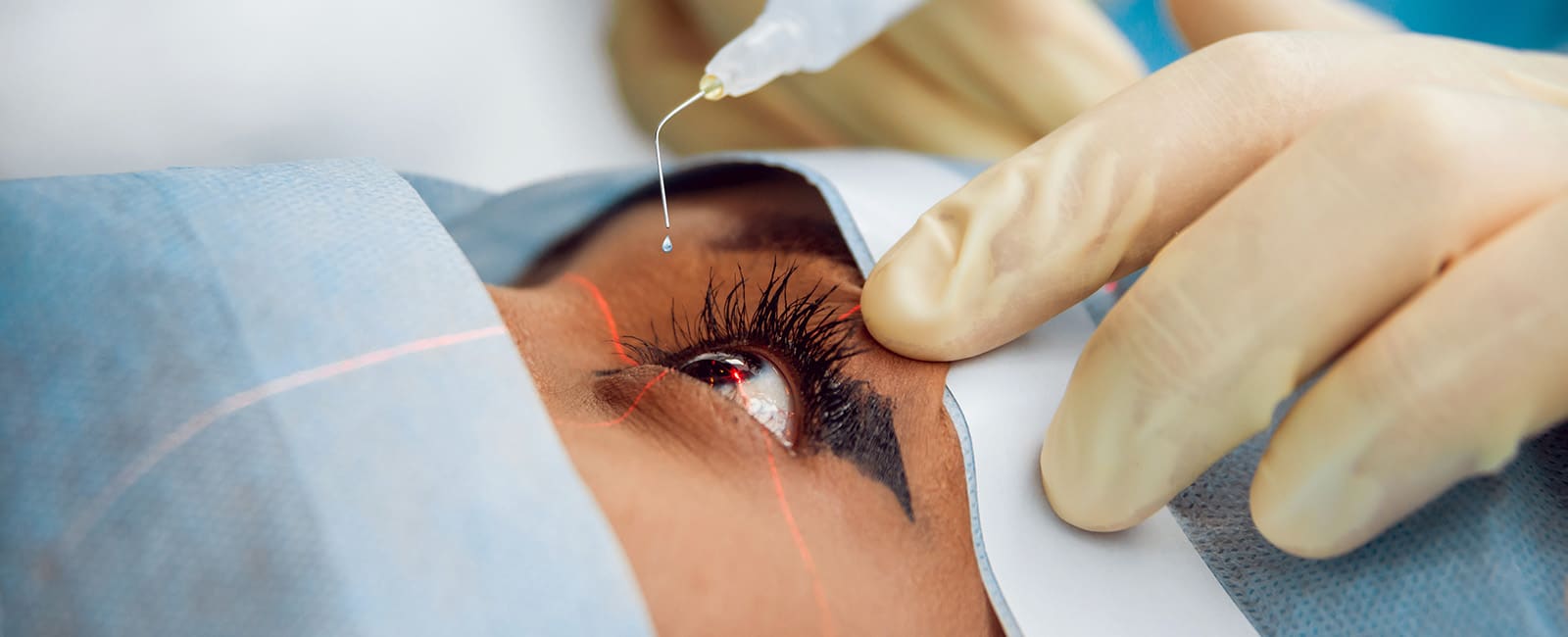 Is Cataract Surgery Safe?