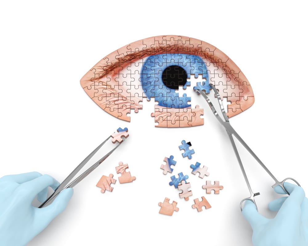 The Top 3 Early Signs of Cataracts — With Photos