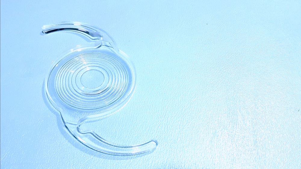 How Long Do Cataract Lenses Last? 