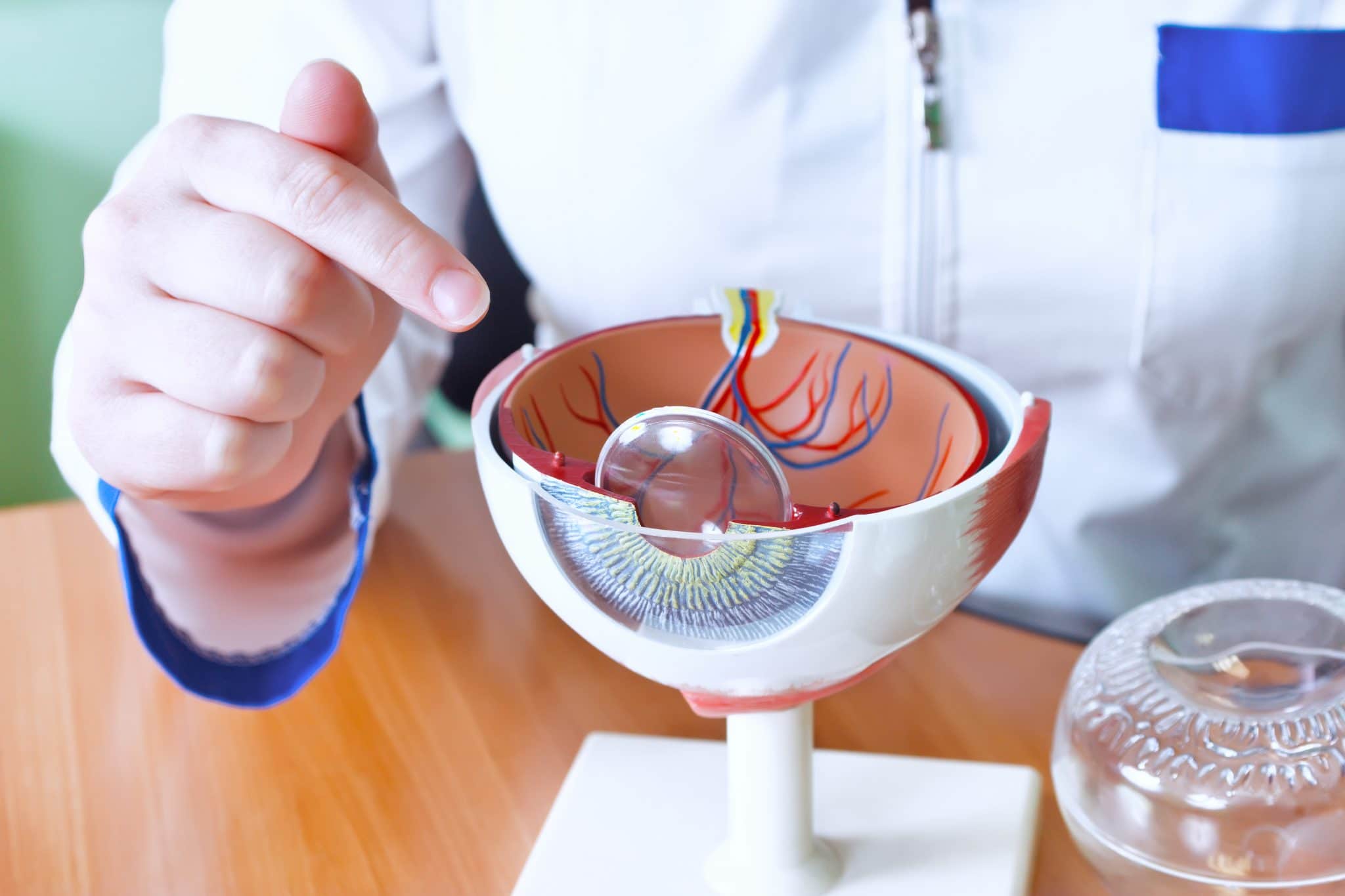 Doctor pointing to a cross-section eye model explaining eye anatomy and surgery