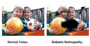 231690-diabetic-retinopathy-vision