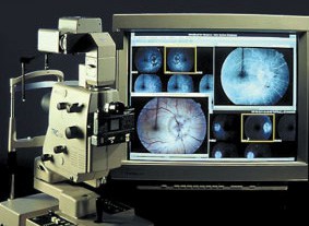 231697-eye-angiography-diagnostic