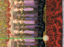 Low level laser energy has been found to shrink spots of drusen in some people. Studies are being conducted to determine if this procedure might stabilize or improve vision.