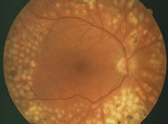 231732-optic-nerve-macula