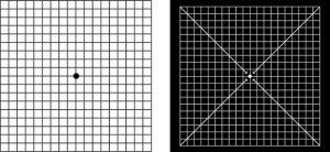 How to use the amsler grid - Towne Lake Eye Associates